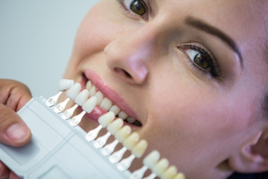 dentista examinando a una paciente con tonos de dientes para explicar los beneficios de las carillas