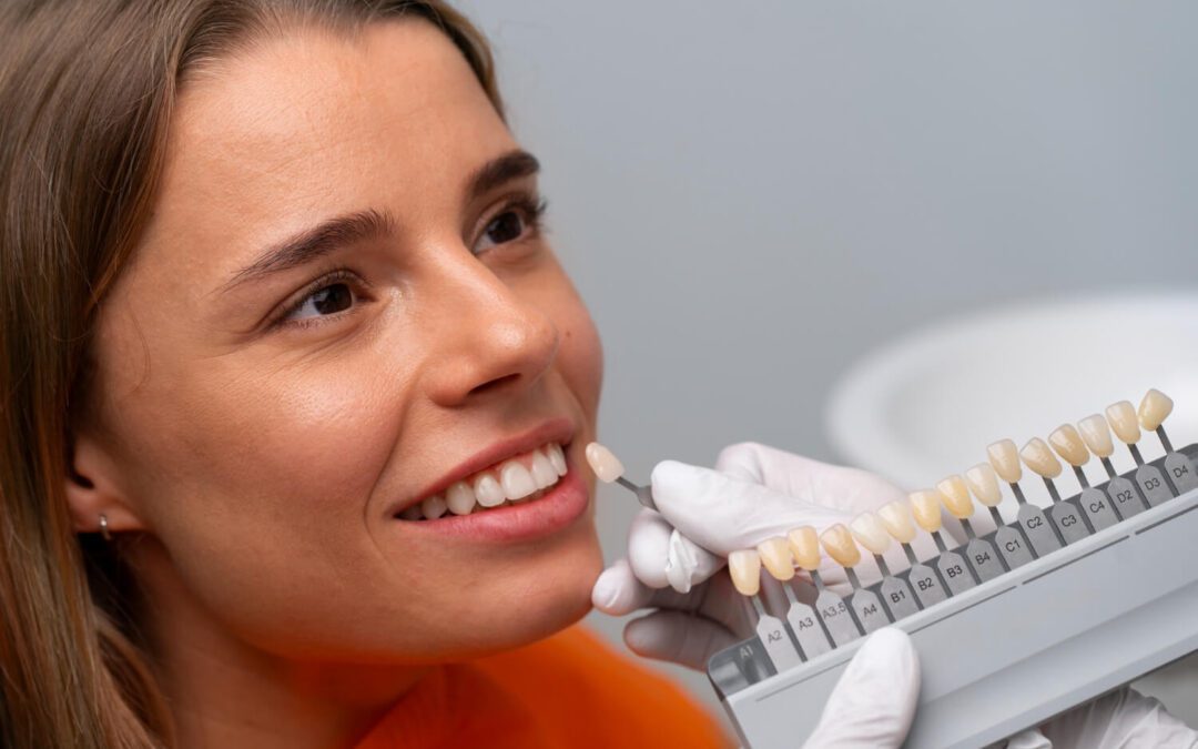 Are Veneers Fake Teeth?
