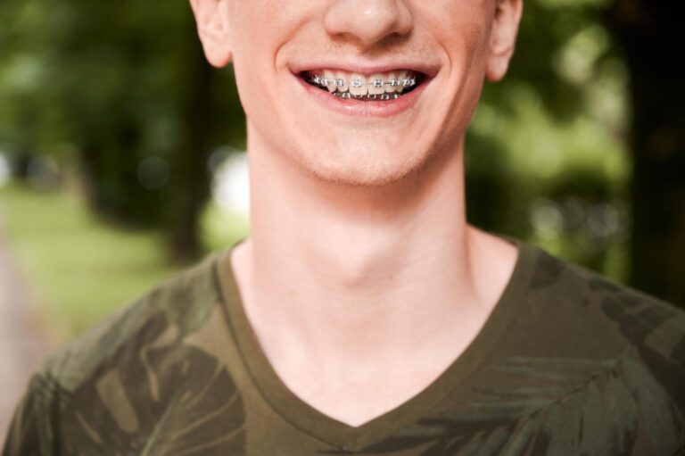 Cheerful young man showing teeth with braces explaining are clear braces better than metal