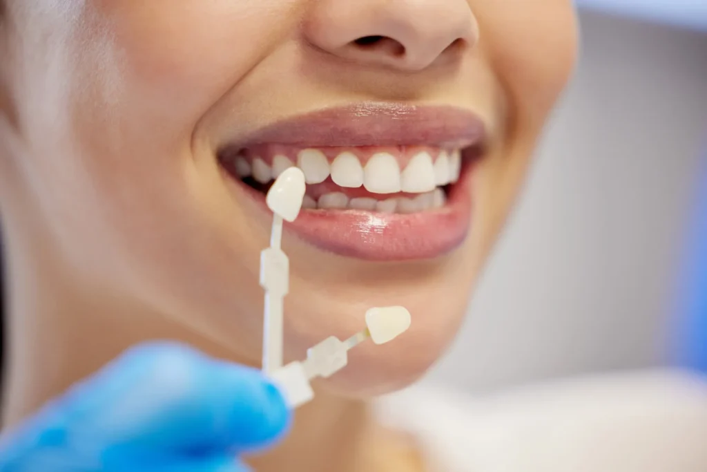 cosmetic dentist fort mill check patient's teeth