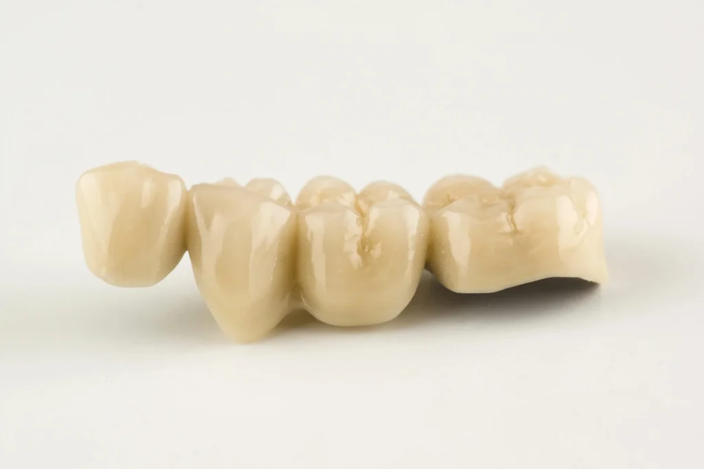 Dental restorations from a cosmetic dentist in Fort Mill.